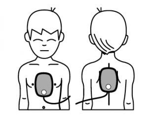 De AED met kinderelektroden gebruiken